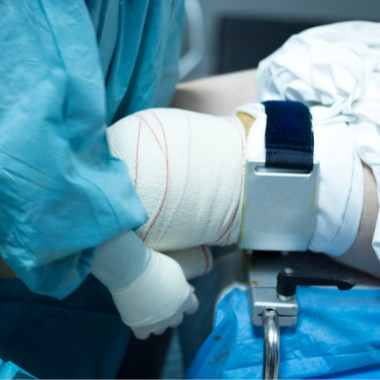 Recuperación de la Cirugía Artroscopia de rodilla