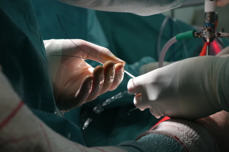 Momento en la cirugía de trasplante de menisco en que se está realizando una sutura. Se ven dos manos de dos doctores que están trabajando juntos