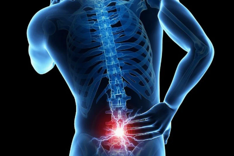 Imagen con fondo negro donde se ve la parte posterior de un cuerpo, dibujado en color azul, desde la base del cuello hasta la base de la espalda. Marcando una zona de dolor en color rojo en la zona lumbar.