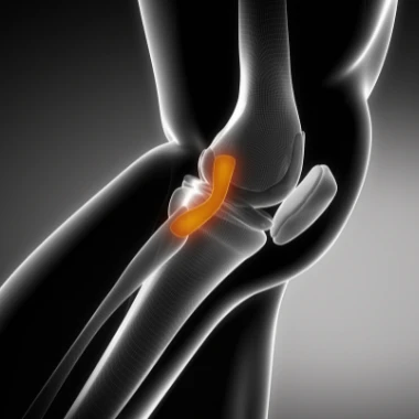 Vista lateral de la zona de la rodilla con el ligamento cruzado anterior destacado en color naranja