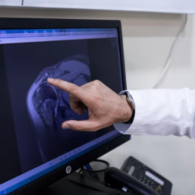 La mano de un doctor señala un punto de una radiografía que está visionando en una pantalla de ordenador