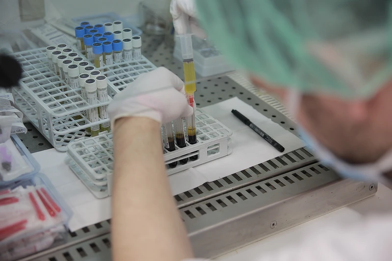 La imagen muestra a un profesional de laboratorio manipulando tubos de ensayo que contienen sangre centrifugada. Se puede ver claramente el plasma separado en la parte superior de los tubos. El profesional lleva guantes y una mascarilla, trabajando sobre una mesa equipada con una rejilla de ventilación. Al fondo, se observan más tubos de ensayo organizados en una bandeja. La escena refleja un procedimiento relacionado con la preparación de PRP (Plasma Rico en Plaquetas).
