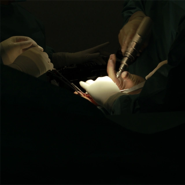Unidad protesis – Tipo de protesis que realizamos Primer plano de las manos de un cirujano con guantes blancos utilizando un dispositivo quirúrgico motorizado sobre la zona iluminada de una intervención, con un fondo en penumbra.