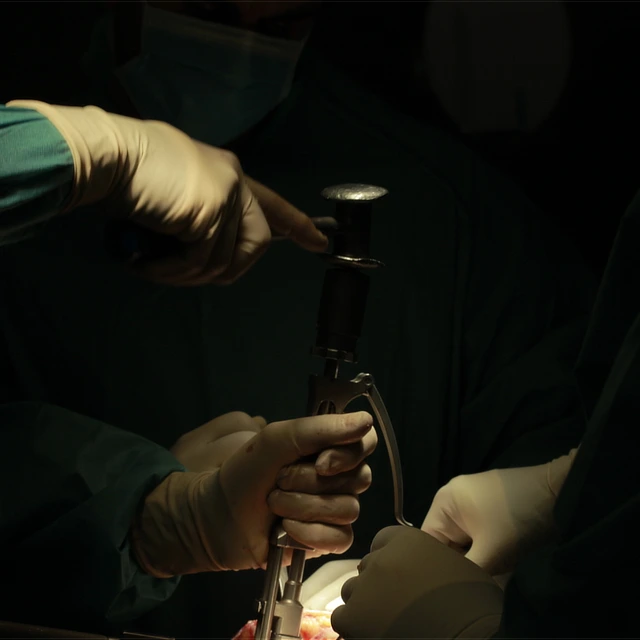 Unidad protesis – que tipo de pacientes tratamos Detalle en primer plano de unas manos con guantes quirúrgicos estériles de color claro sosteniendo y ajustando una herramienta o instrumental médico metálico de precisión en un quirófano oscuro.