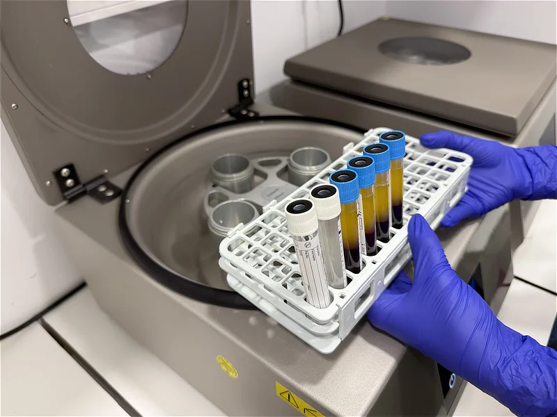 Primer plano de unas manos con guantes azules de nitrilo colocando una gradilla blanca con tubos de ensayo en una máquina centrifugadora de laboratorio abierta. Los tubos contienen sangre fraccionada en capas de plasma amarillento y glóbulos rojos.